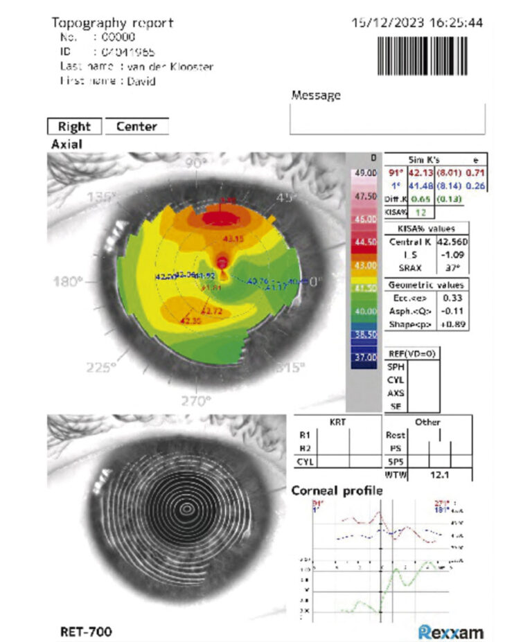 Capsulo, Laser YAG, lasers da marca Quantel Medical