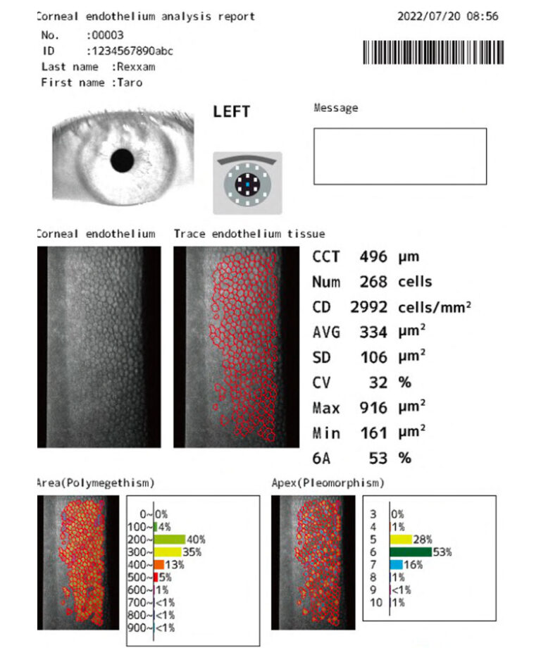 SPM-700, Microscópio Especular, da marca REXXAM