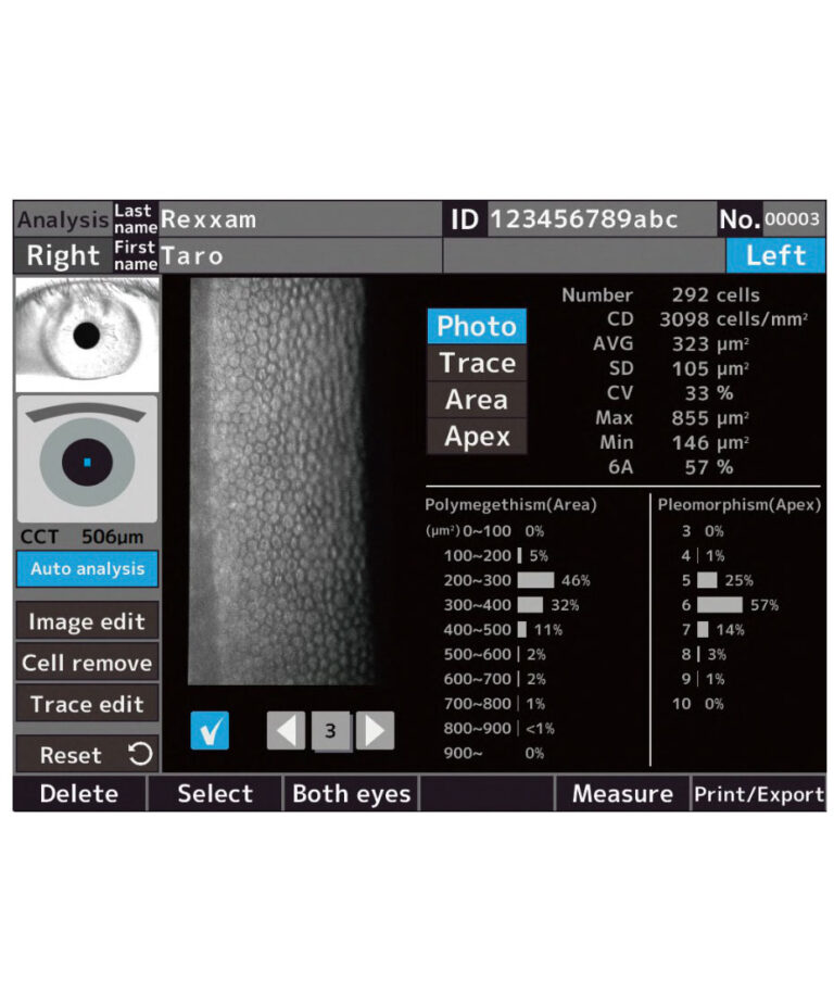 SPM-700, Microscópio Especular, da marca REXXAM