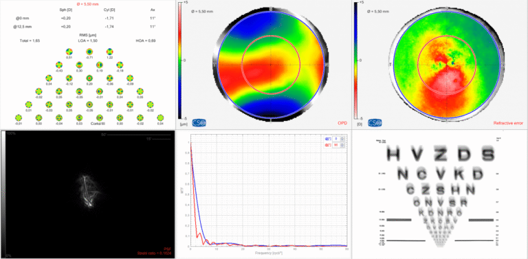 Simulações visuais PSF, MTF e optotipo no software Phoenix do OSIRIS-T CSO