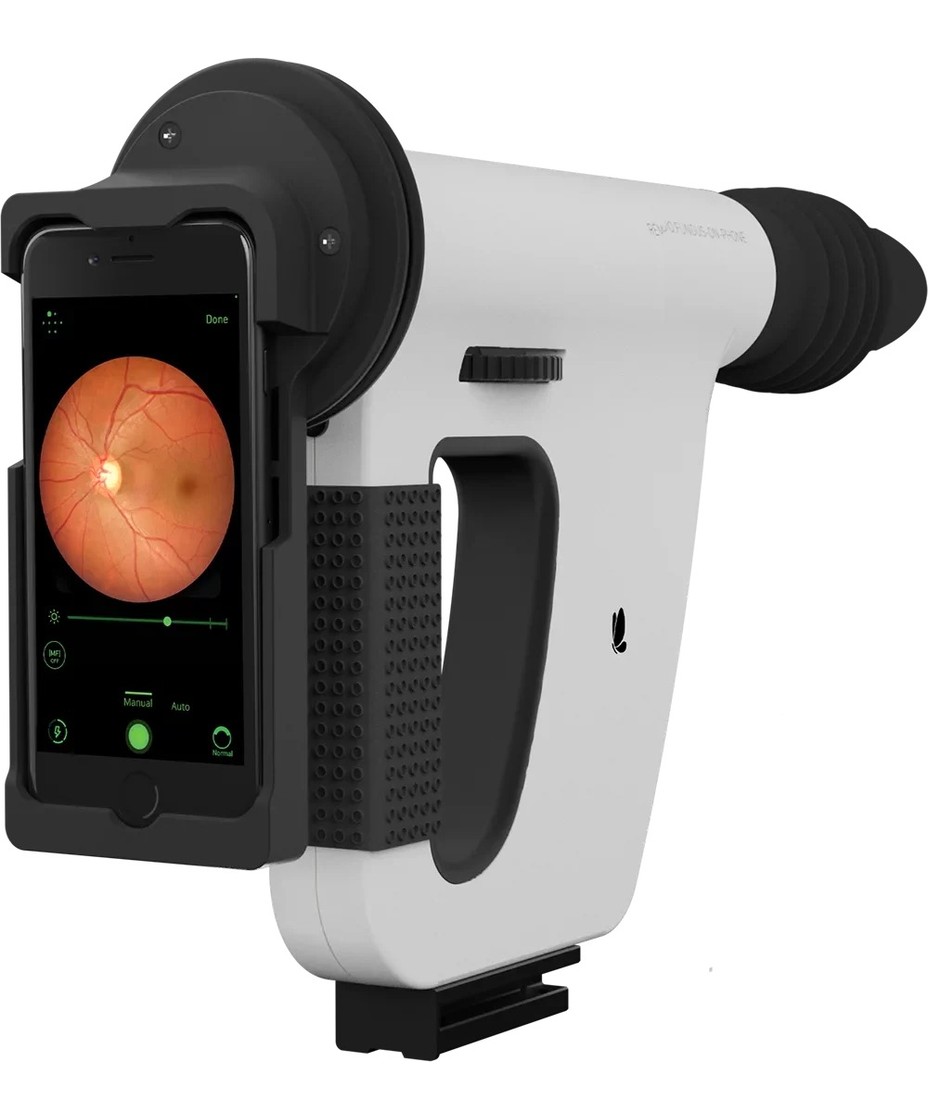 FOP NM-10, retinógrafo portátil não midriático da Remidio